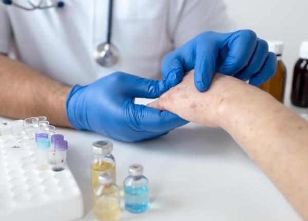 lupus o boala autoimuna complexa lupus o boala autoimuna complexa