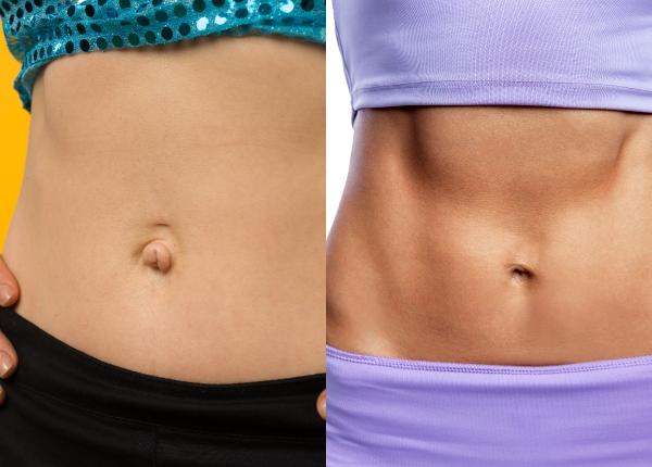 motivul pentru care unii au buricul in afara iar altii spre interior