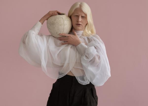 albinismul genetica sau cauze externe cea mai periculoasa activitate care poate duce la complicatii albinismul genetica sau cauze externe cea mai periculoasa activitate care poate duce la complicatii