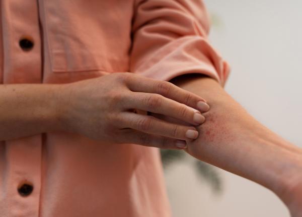 boala lyme cauze simptome tratament care sunt primele semne care te pot trimite la urgente