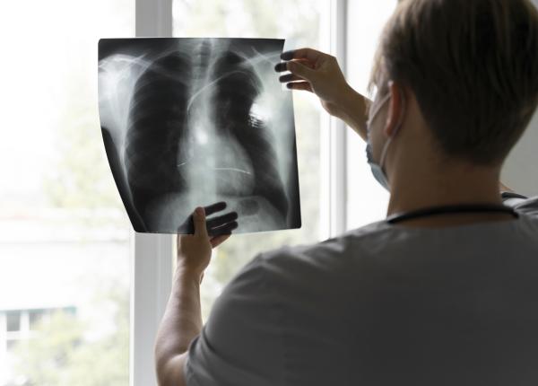 pleurezia sau apa la plamani cauze diagnostic si tratament pleurezia sau apa la plamani cauze diagnostic si tratament