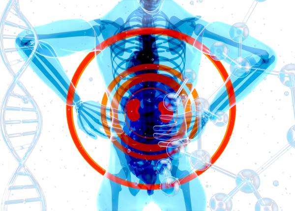 nisip la rinichi litiaza renala medic urolog mihai dobra