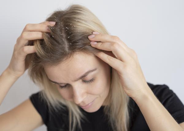 dermatita seboreica cum sa o identifici si sa o tratezi corect