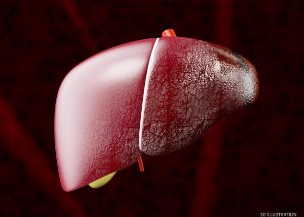 detectarea timpurie a bolilor hepatice detectarea timpurie a bolilor hepatice