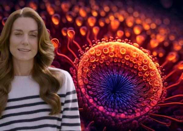 medic oncolog kate middleton cancer ileostomie temporara sunt mai greu de vindecat