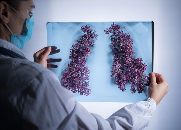 cine este mai predispus la cancer pulmonar cine este mai predispus la cancer pulmonar
