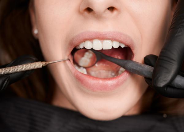 boala gingivala care duce la pierderea dintilor boala gingivala care duce la pierderea dintilor