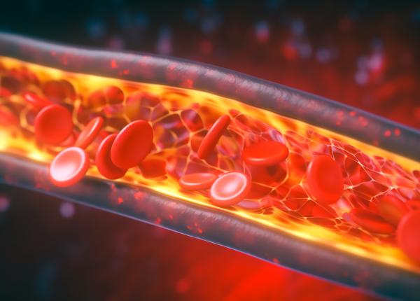 impactul alimentatiei asupra nivelului trigliceridelor
