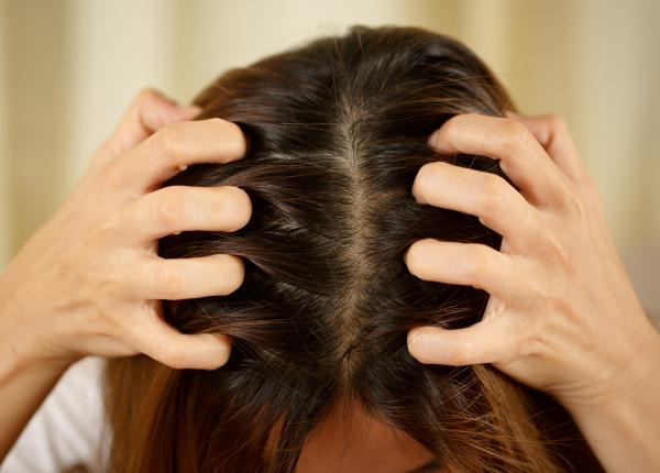 mancarimea scalpului de ce apare si cum sa o gestionezi corect