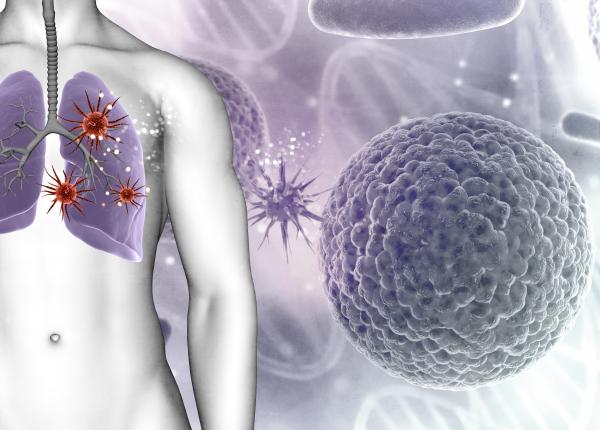 tratamentul pentru cancerul pulmonar aprobat de fda tratamentul pentru cancerul pulmonar aprobat de fda