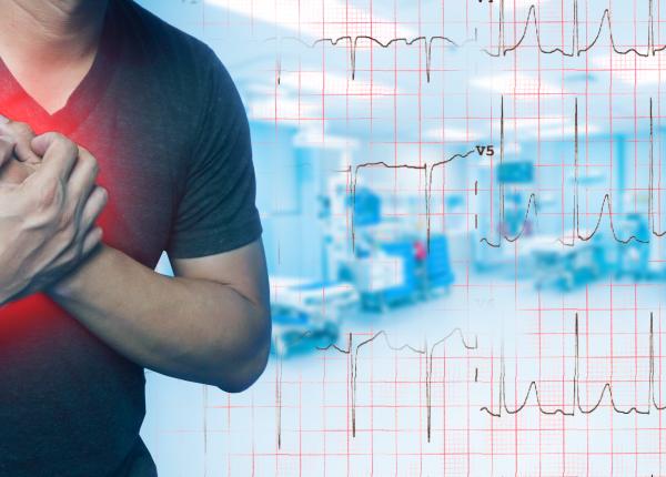 care este intervalul de timp in care poti fi recuperat total dupa infarct soc cardiogenic care este intervalul de timp in care poti fi recuperat total dupa infarct soc cardiogenic
