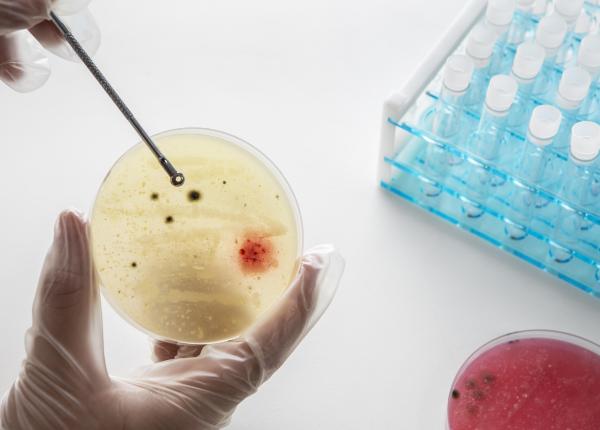 vsh mare cauzele care duc la cresterea lui analiza pe care sa o faci daca ai un vsh mare vsh mare cauzele care duc la cresterea lui analiza pe care sa o faci daca ai un vsh mare