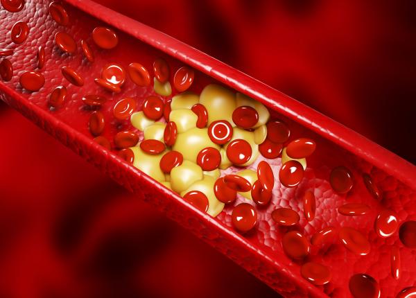legatura dintre colesterol si inflamatie o combinatie periculoasa pentru inima