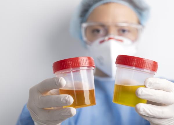 litiaza de acid uric boala metabolica mihai dobra dezechilibru acidului uric guta litiaza de acid uric boala metabolica mihai dobra dezechilibru acidului uric guta