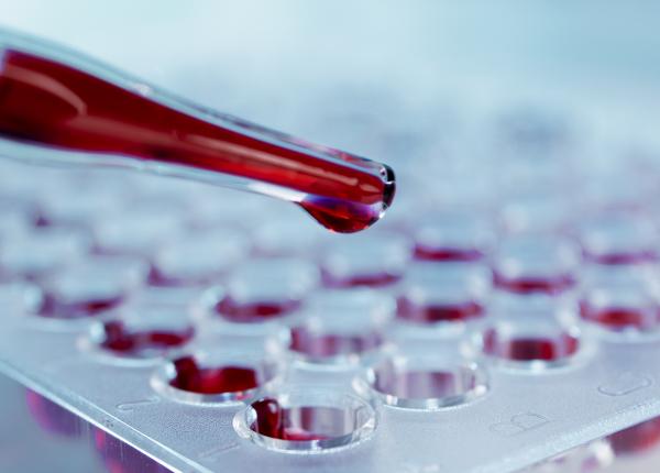 testul de sange pentru cancerul colorectal un pas important spre detectarea precoce