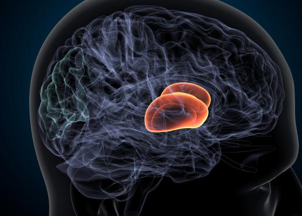 ce este de fapt atacul ischemic tranzitoriu