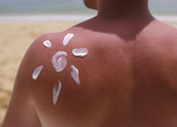 arsuri solare vs intoxicatii solare diferente simptome si tratament arsuri solare vs intoxicatii solare diferente simptome si tratament