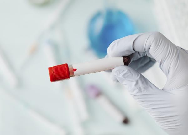 ce inseamna daca ai transaminazele crescute