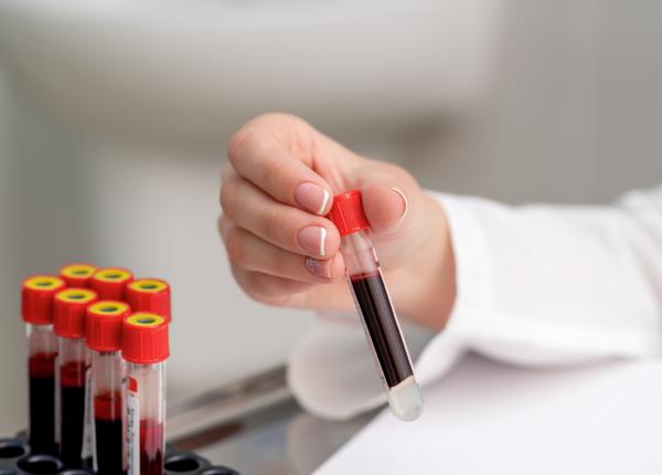 testul de sange care poate schimba viitorul diagnosticarii bolii parkinson