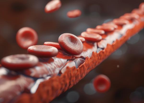 cele trei semne care iti arata ca ai colesterolul marit sunt vizibile cu ochiul liber