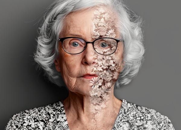 alzheimer cum poate ai sa prezica riscul cu aproape 80prc