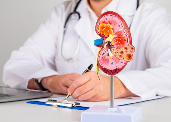 pietrele la rinichi simptome cauze si cand sa ceri ajutor medical pietrele la rinichi simptome cauze si cand sa ceri ajutor medical
