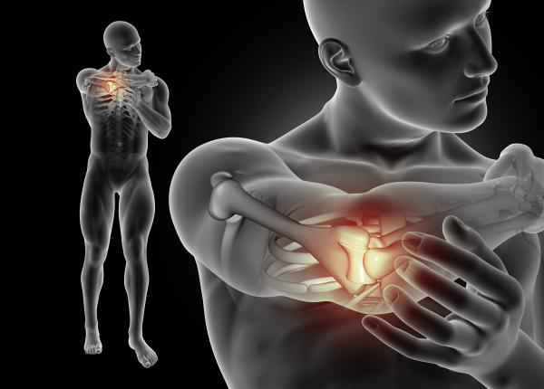 hook test examenul clinic pentru ruptura de tendon a bicepsului dr liviu ojoga inainte de operatie rmn sau ecografie