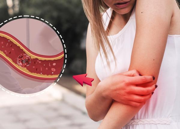 expunerea la soare bomba cu ceas pentru piele olga simionescu carcinomul melanomul expunerea la soare bomba cu ceas pentru piele olga simionescu carcinomul melanomul