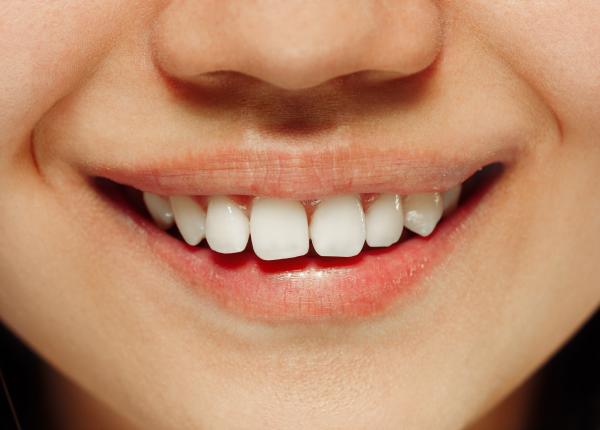 ananas fructul care albeste dintii curata saliva stomatolog inalbitor natural