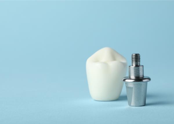 solutii pentru un zambet natural si stralucitor