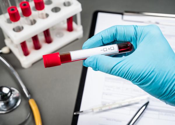 testul de sange pentru cancerul colorectal aprobat de fda poate detecta cu acuratete tumorile din colon sau rect testul de sange pentru cancerul colorectal aprobat de fda poate detecta cu acuratete tumorile din colon sau rect