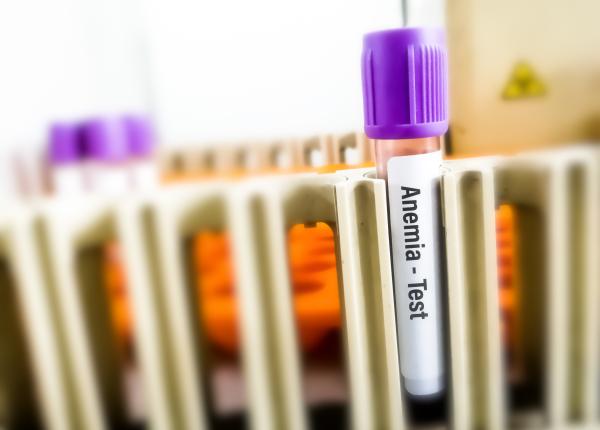 anemia simptome tipuri cauze