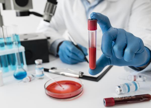 testul de sange cu 90prc acuratete in prezicerea alzheimerului