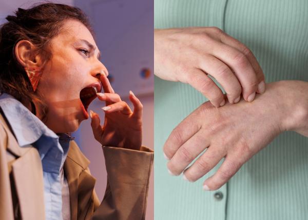 de ce cascatul si scarpinatul sunt contagioase