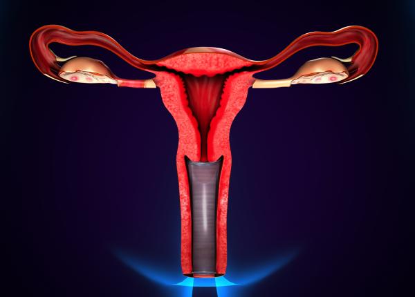 fibrom uterin simptome si testul care pune diagnosticul cele 7 semne ca ai un fibrom uterin fibrom uterin simptome si testul care pune diagnosticul cele 7 semne ca ai un fibrom uterin