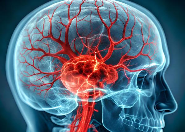 somnul din timpul zilei asociat cu cresterea tensiunii arteriale si cu avc ul