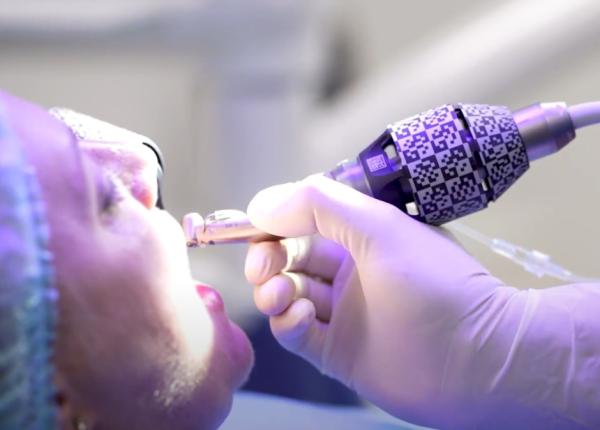 implanturi dentare fara taietura si fara durere