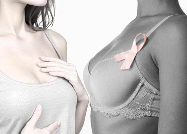 limfedemul complicatia ingrozitoare a cancerului de san dr stefan voiculescu este cea mai de temut se umfla foarte mult limfedemul complicatia ingrozitoare a cancerului de san dr stefan voiculescu este cea mai de temut se umfla foarte mult