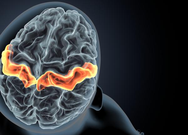 avc semne usor de trecut cu vederea avc semne usor de trecut cu vederea