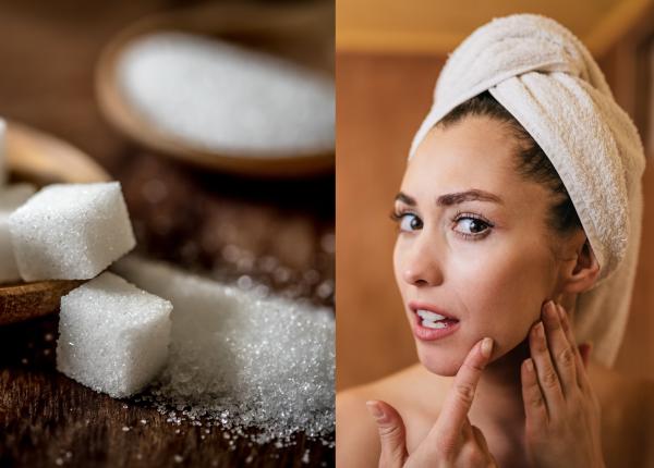 zaharul si sanatatea pielii semne vizibile ale daunelor cauzate de zahar