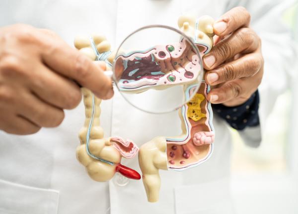 cancerul colorectal apare la tot mai multi tineri cauza alarmanta care provoaca boala e ingrijorator cancerul colorectal apare la tot mai multi tineri cauza alarmanta care provoaca boala e ingrijorator