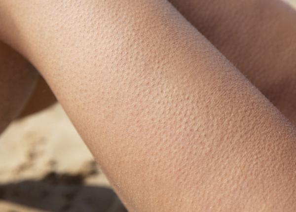 de ce ti se face pielea de gaina legatura neasteptata dintre frica frig si emotii de ce ti se face pielea de gaina legatura neasteptata dintre frica frig si emotii