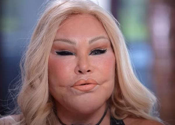 jocelyne wildenstein supranumita catwoman s a stins la varsta de 84 de ani era cunoscuta pentru multitudinea de interventii estetice