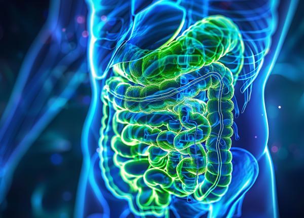 calciul impactul asupra riscului de cancer colorectal