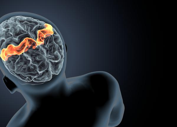 cauza ciudata care duce la avc