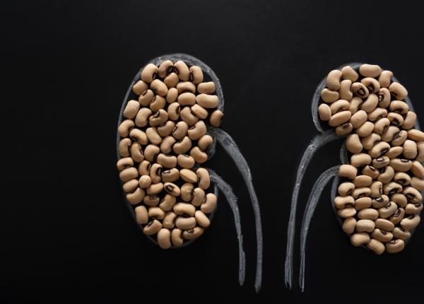 la ce dimensiuni poate ajunge un calcul renal la ce dimensiuni poate ajunge un calcul renal