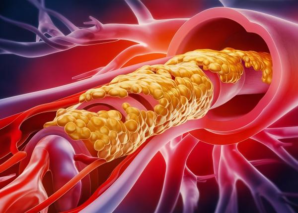 schimbarile dietetice impact asupra colesterolului