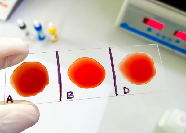 testul care arata daca ai anemie si cancer de colon dr buliga iti spune clar daca ai sau nu testul care arata daca ai anemie si cancer de colon dr buliga iti spune clar daca ai sau nu