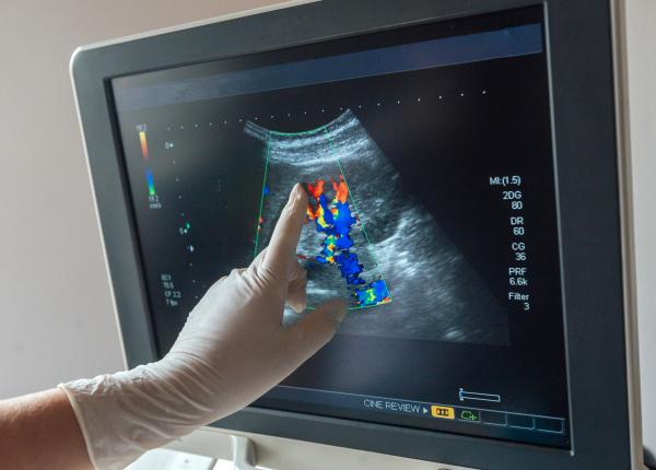 diagnosticul pe care multi il afla la un simplu ecograf abdominal dr adrian dijmarescu descopera la o examinare de ficat colecist pancreas diagnosticul pe care multi il afla la un simplu ecograf abdominal dr adrian dijmarescu descopera la o examinare de ficat colecist pancreas