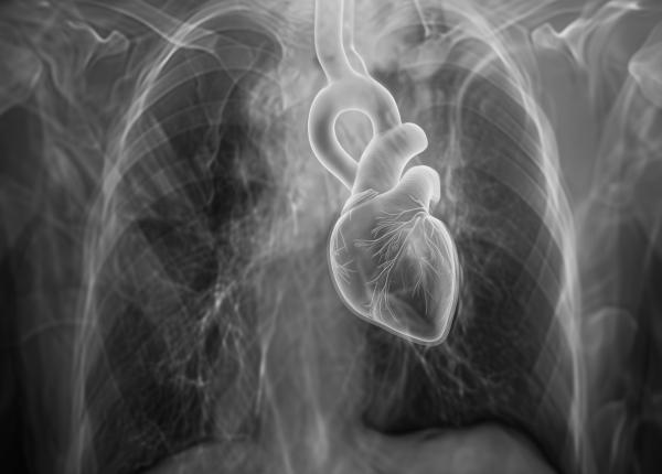 medicamentul care poate opri inlocuirea valvei aortice si boala inimii reduce calcifierea cu 70prc medicamentul care poate opri inlocuirea valvei aortice si boala inimii reduce calcifierea cu 70prc
